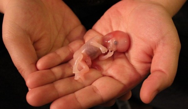 Stunning Photo Of Noah Miscarried At 12 Weeks Shows LIFE In The Womb 