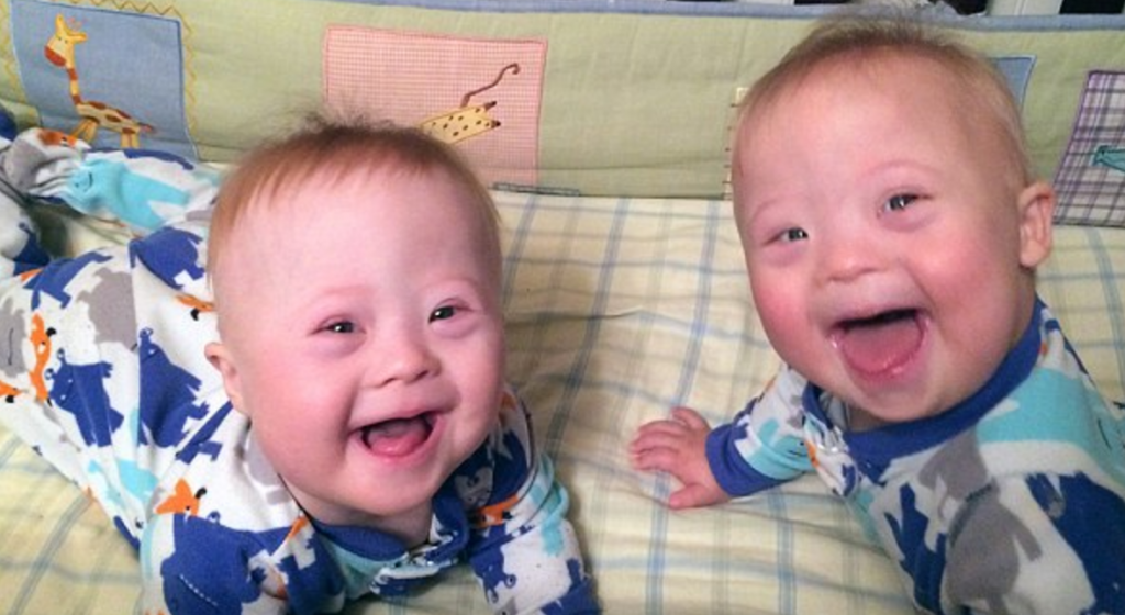 mother-45-discovered-her-unborn-twins-had-down-syndrome-and-really